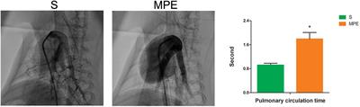 Association Between Inflammatory Mediators and Pulmonary Blood Flow in a Rabbit Model of Acute Pulmonary Embolism Combined With Shock